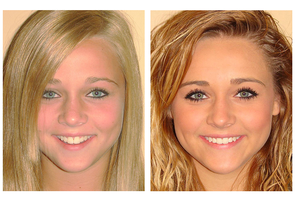 Horizon Palms Family Dentistry