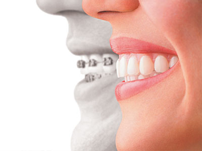 The image shows a split-screen comparison between a person s natural teeth and a dental implant, highlighting the difference in appearance and possibly promoting dental health services.