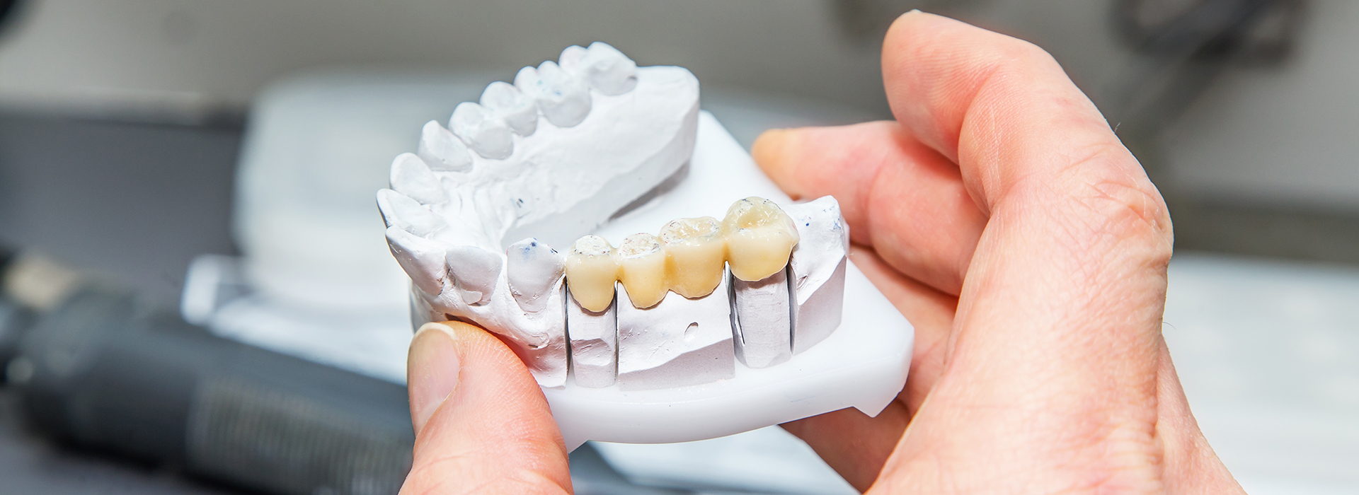 The image shows a person holding a white plastic model of a human mouth with teeth, possibly for educational or demonstration purposes.