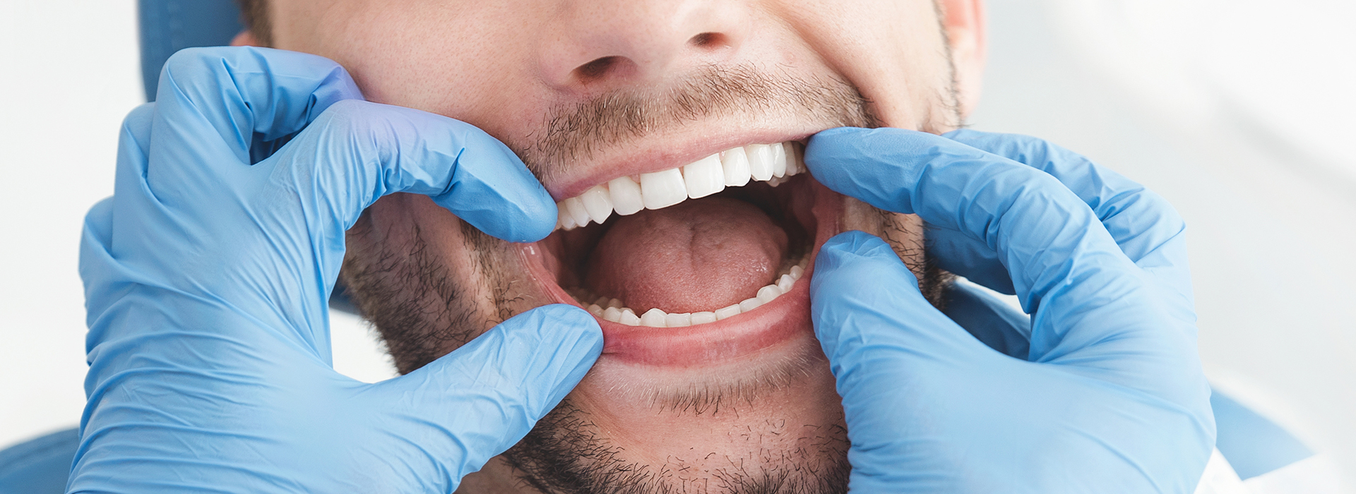 The image shows a man with his mouth open wide, appearing to be in the process of having dental work done, with a dental professional wearing blue gloves and a mask holding a dental tool near his teeth.