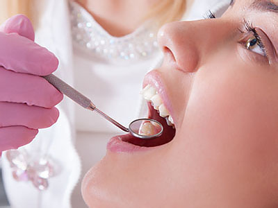 A woman receiving dental treatment with a pair of tweezers being used on her teeth by a professional.