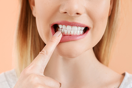 The image shows a close-up of a woman with her finger on her teeth, posing for a selfie with a playful expression.